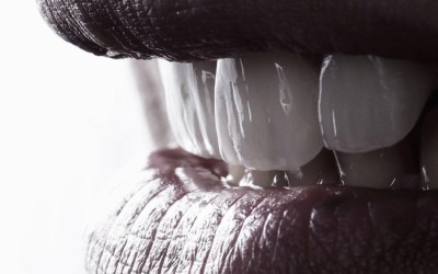 Бондингът – бързата пътека към съвършената усмивка